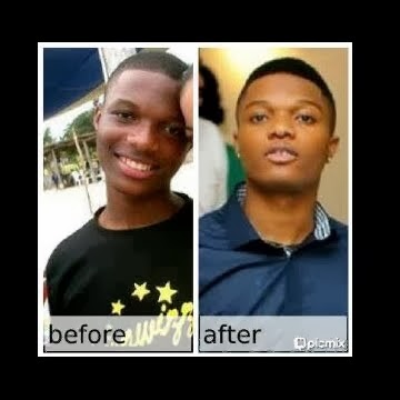 preview of Wizkid-before and after.jpg